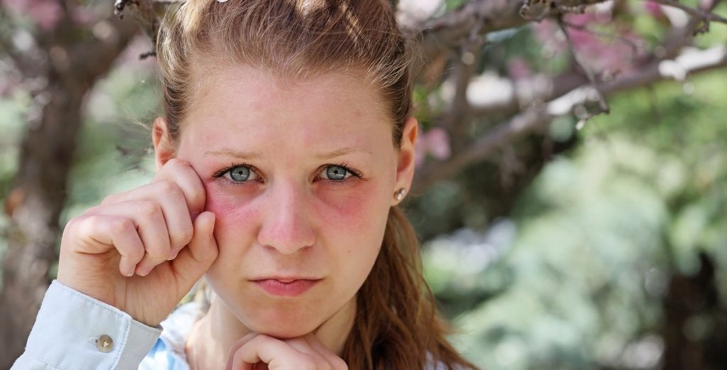 Hava Temizleme Cihazları: Lüks Mü, Zorunluluk Mu? 14 Hava Temizleme Cihazları: Lüks mü, Zorunluluk mu? - image 58